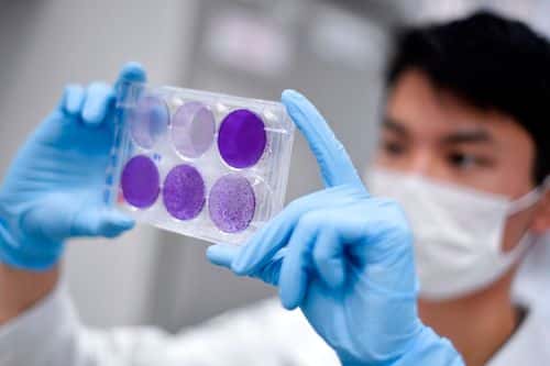 Brasiliansk forsker undersøger virus
