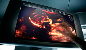 Skærm viser scannningsbillede af foster